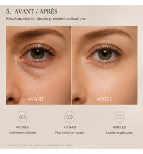 Zenaterra-EyeRevive360 masseur yeux anti-cerne-Sun&Sia-Rollers