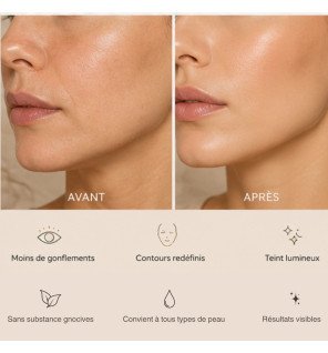 Masseur visage Caudale par thermothérapie