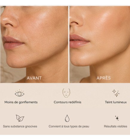 Masseur visage Caudale par thermothérapie