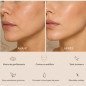 Masseur visage Caudale par thermothérapie Masseur visage Caudale par thermothérapie